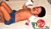 বগুড়ায় বাসের ধাক্কায় ছিড়ে গেল শিশু কন্যার হাত :